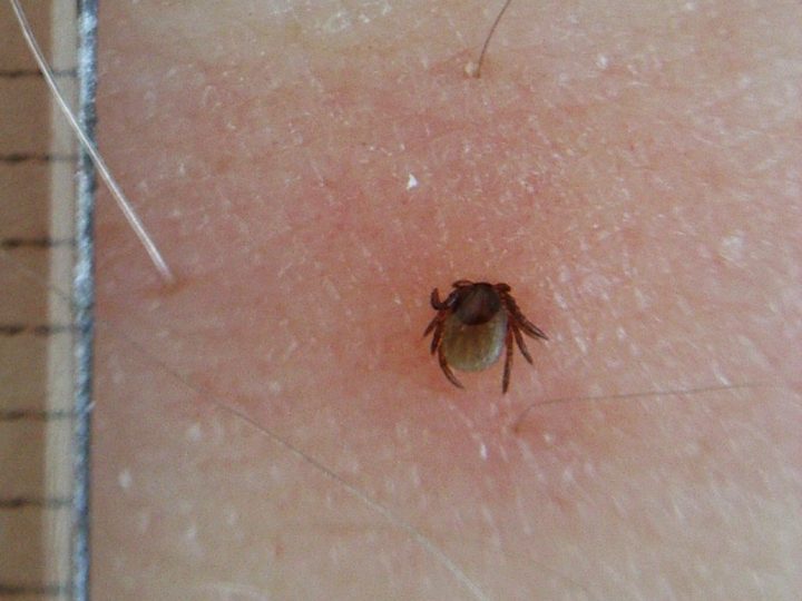 Punkkikausi lähestyy myös Lohjalla – TBE-rokotteen ajoitus kannattaa hoitaa kuntoon ennen kesää